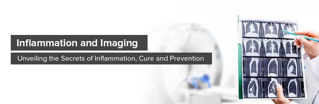 Inflammation and Imaging: Unveiling the Secrets of Inflammation, Cure, and Prevention